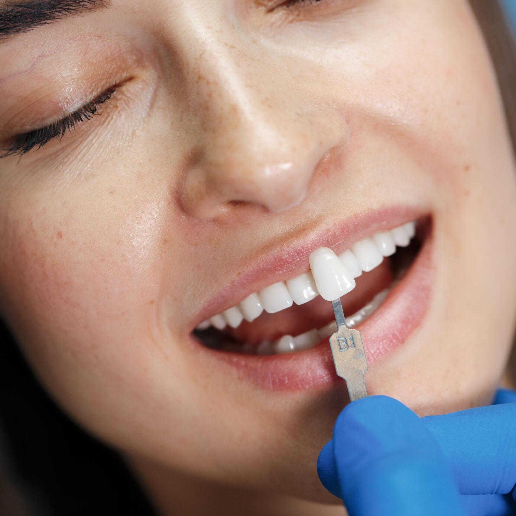 dentist-white-teeth